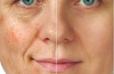 1414933_736570773039203_1693015765_n