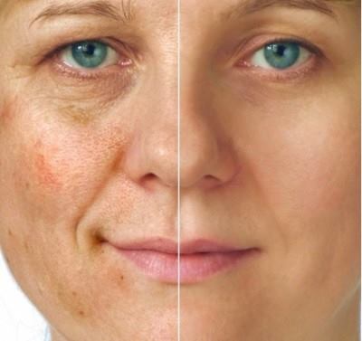 1414933_736570773039203_1693015765_n