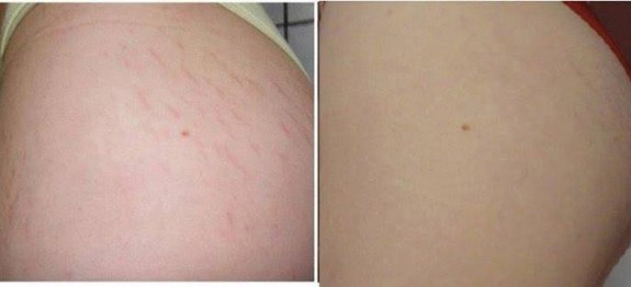 1506610_546848435404689_2040375422_n