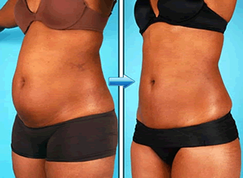 receita-caseira-para-perder-barriga