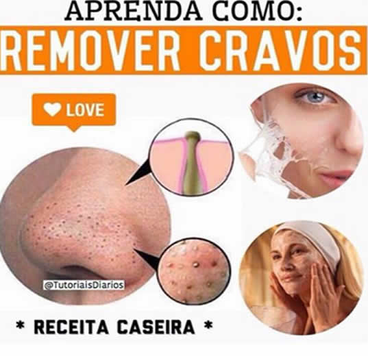 Cravos na pele- aprenda a fazer cera caseira que remove os pontinhos pretos