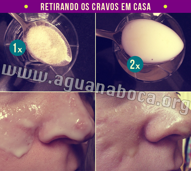 Exterminando os Cravos em casa com Receitinha Caseira