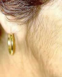 Tratamento caseiro para acabar com os pelos do rosto