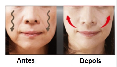 4 dicas para levantar as bochechas caídas - Veja a Receita: