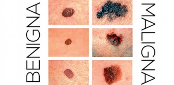 quando-pinta-perigosa-02-610×300