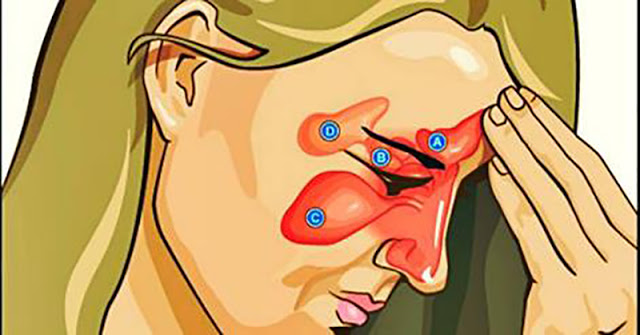 receita-caseira-sinus