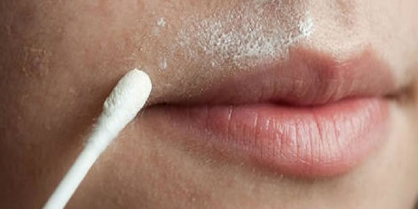 Remédio-Natural-para-Depilar-o-Buço-para-Sempre