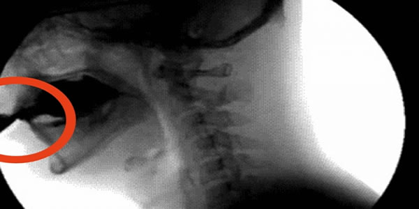 Este-veneno-destrói-os-ossos.-Mas-há-pessoas-que-o-bebem-todos-os-dias.