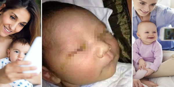 História-do-bebê-que-ficou-cego-por-causa-de-flash-pode-ser-farsa