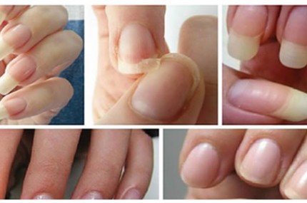 O-Melhor-Fortalecedor-de-Unhas-do-Mundo-Você-Faz-em-Casa-430×285