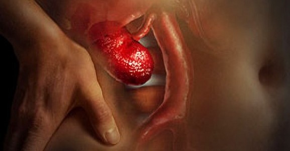 cálculos-nos-rins-2-577×300