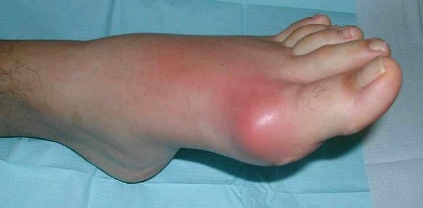 cido_rico_novo-610×300