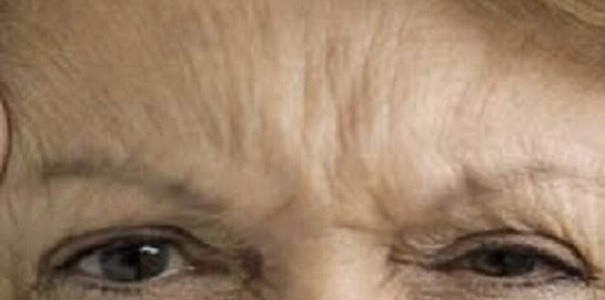 rugas-4-edit-605×300