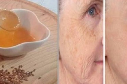 Poderosa-e-econômica-fórmula-antienvelhecimento-e-antirrugas-caseira-430×285