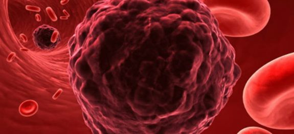 cientistas-descobrem-composto-quimico-que-faz-celulas-cancerigenas-se-autodestruirem-b92fc295