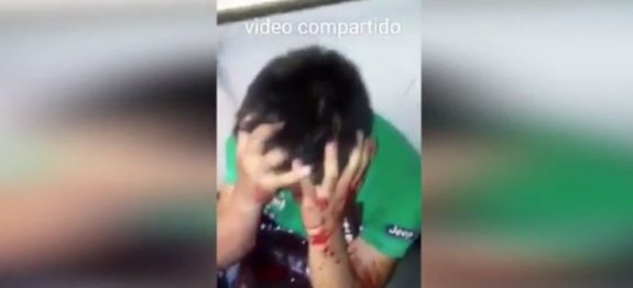 Mulher-assediada-no-metro-reage-e-agride-o-Abusador