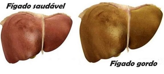 figado_gordo_-_tamarindo_-_edit