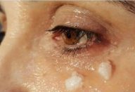 oleo_de_coco_-_olhos_-_edit