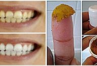 pasta_de_dentes_-_fluor_-_acafrao