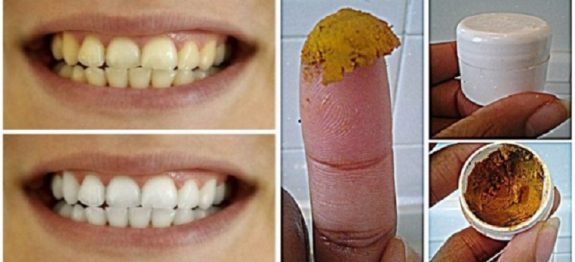 pasta_de_dentes_-_fluor_-_acafrao