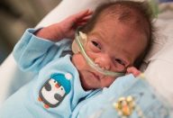 bebe.nasce.apos.morte.cerebral.da.mae.1