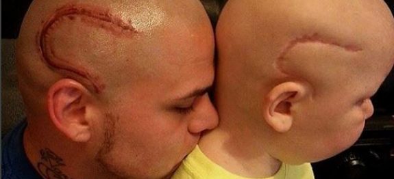 pai-tatuagem-filho-cancer