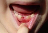 Dentesdeleite2-760×397