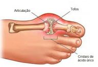 La-gota-500×325-500×325