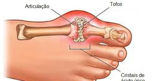 La-gota-500×325-500×325