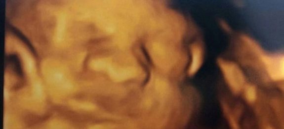 bebe-orgaos-3-760×760