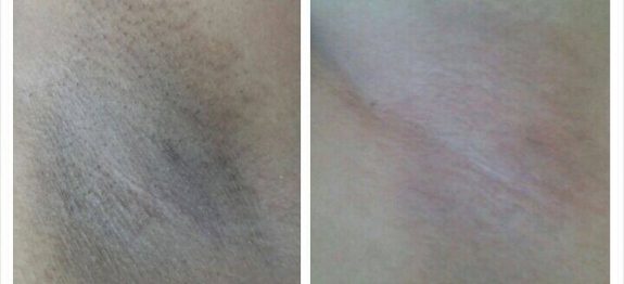 10178143_326017130937196_5833342313601681981_n1