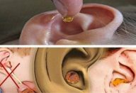 acabe-com-a-cera-dos-ouvidos-de-forma-natural-430×285