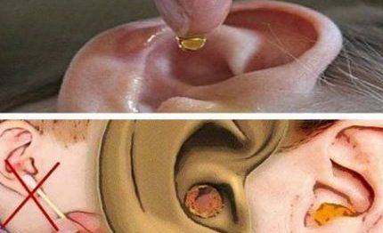 acabe-com-a-cera-dos-ouvidos-de-forma-natural-430×285