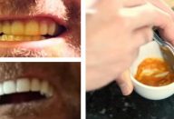 este-homem-clareia-os-dentes-com-um-truque-absurdamente-simples-430×285