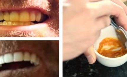 este-homem-clareia-os-dentes-com-um-truque-absurdamente-simples-430×285