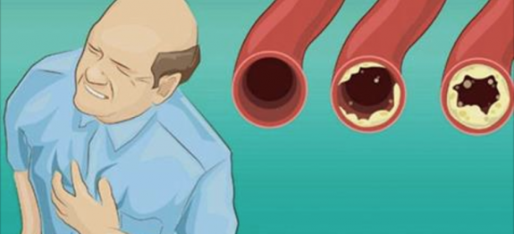 alimentos_-_arterias