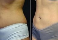 barriga_-_dieta_-_14_dias_ed