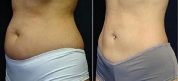 barriga_-_dieta_-_14_dias_ed