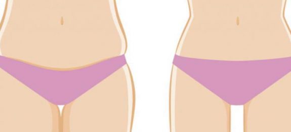 eliminar-a-gordura-das-coxas