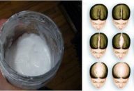 bicarbonato-de-sodio-shampoo-ele-vai-fazer-seu-cabelo-crescer-impressionante-430×285