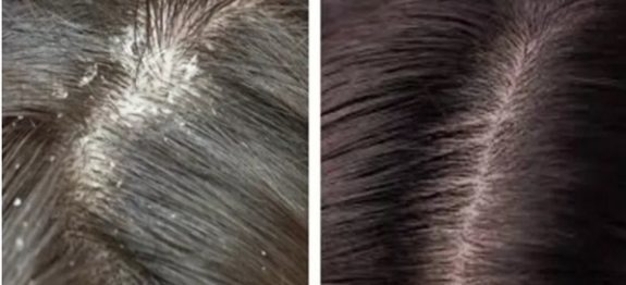 cabelo