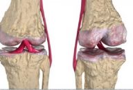 2b30086907789c8b1a0fe4a8b2920d4a