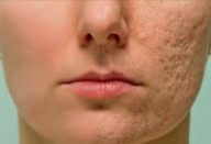 5b438a3153f0a39121a19e49c4a3d0b6