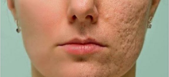 5b438a3153f0a39121a19e49c4a3d0b6