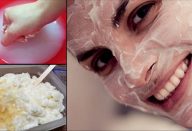 arroz_-_cicatrizes_e_manchas