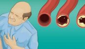 arterias_-_coracao_-_alimentos_e_receitas_ed