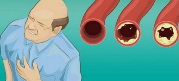 arterias_-_coracao_-_alimentos_e_receitas_ed