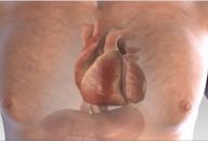 ataque_cardiaco_-_novo_ed