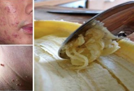 casca_de_banana_-_novo