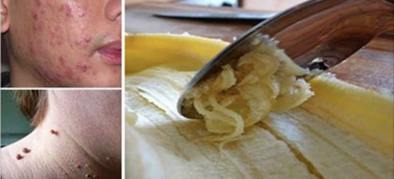 casca_de_banana_-_novo